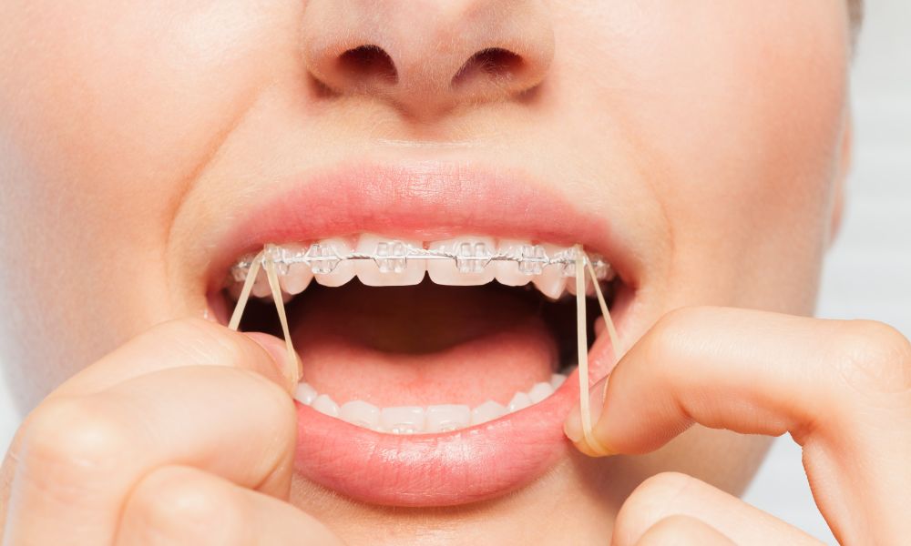 Beneficios de la Ortodoncia