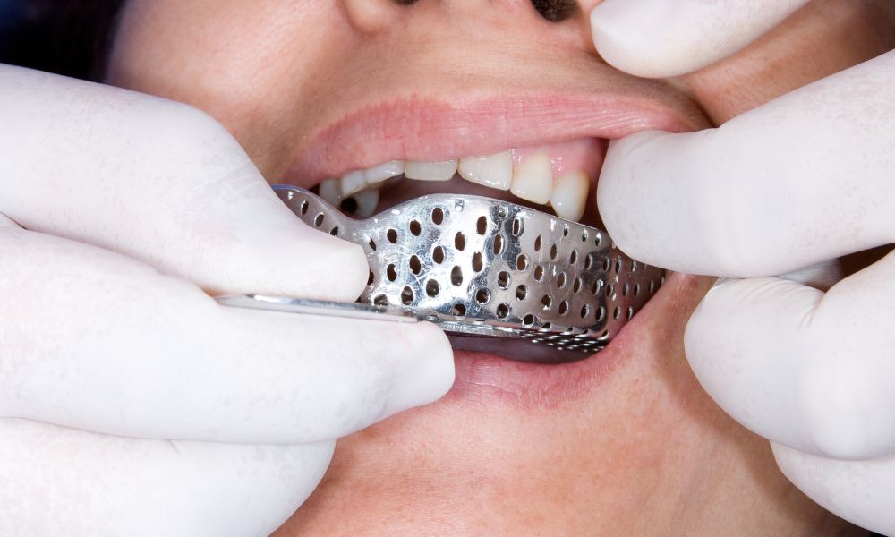 Diferencias entre Rehabilitación Oral y Otros Tratamientos Dentales