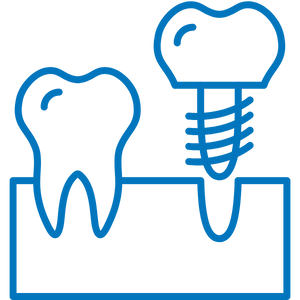 Dental Implants