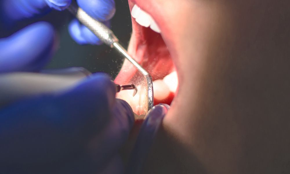 Importancia de la Cirugía Maxilofacial