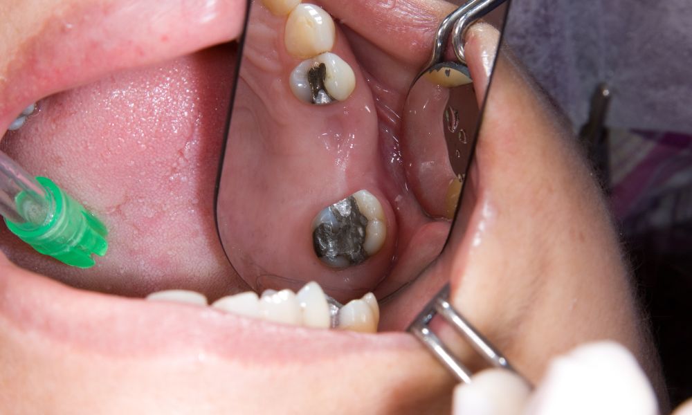 Preguntas Frecuentes sobre Rehabilitación Oral