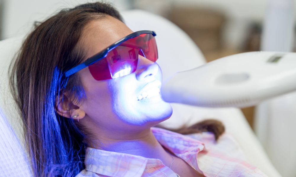 Proceso de Blanqueamiento Dental
