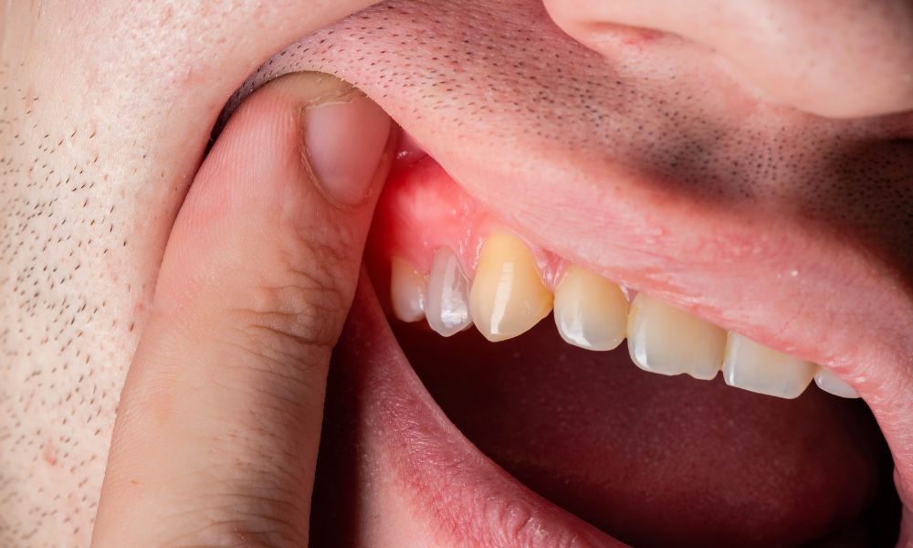 What is Periodontics?