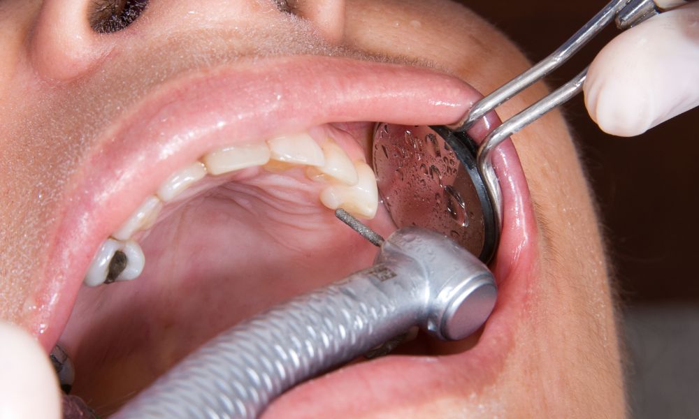 Qué es la Rehabilitación Oral