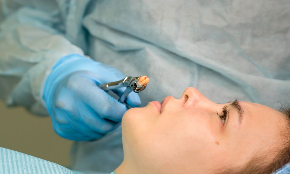 Factors Influencing the Price of Wisdom Tooth Extraction