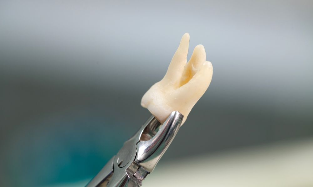 Types of extraction