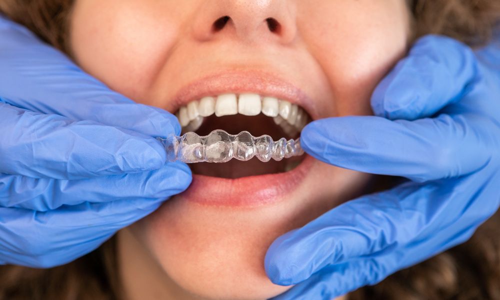 Ventajas Uso Invisalign