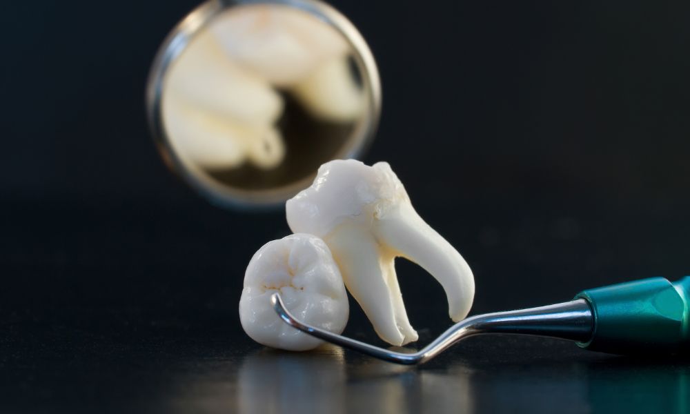 Frequently Asked Questions About Wisdom Teeth Removal