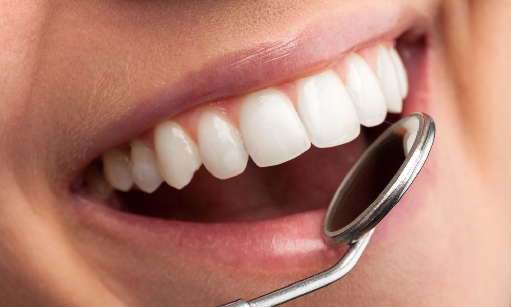 Corrige tu Sonrisa Gingival Guía y Consejos