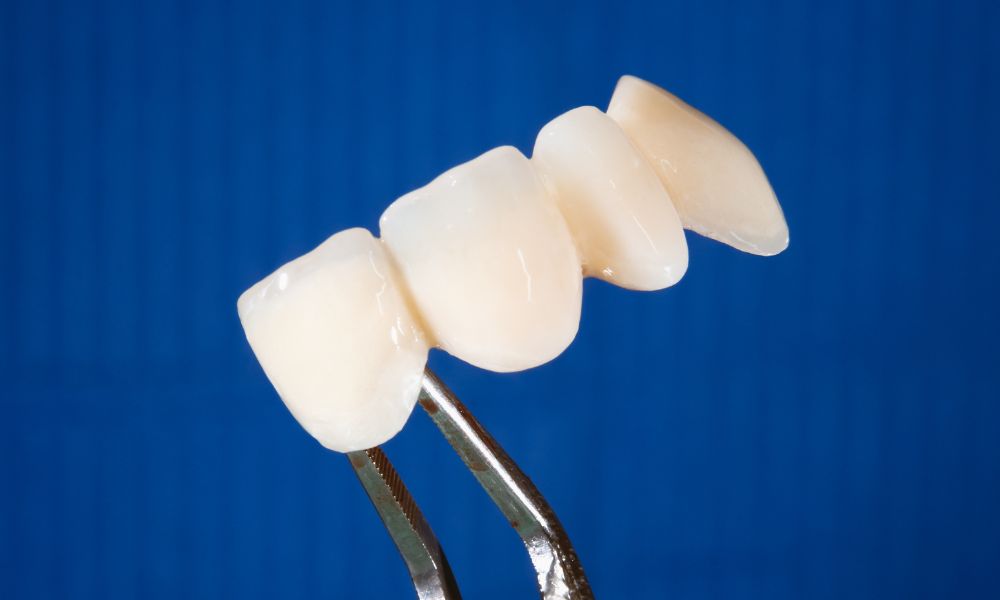 Price of Porcelain Crowns and Bridges in Panama