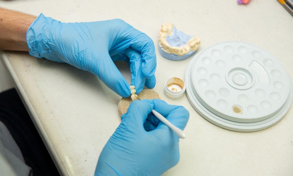Preguntas Frecuentes sobre Prótesis Dental Fija