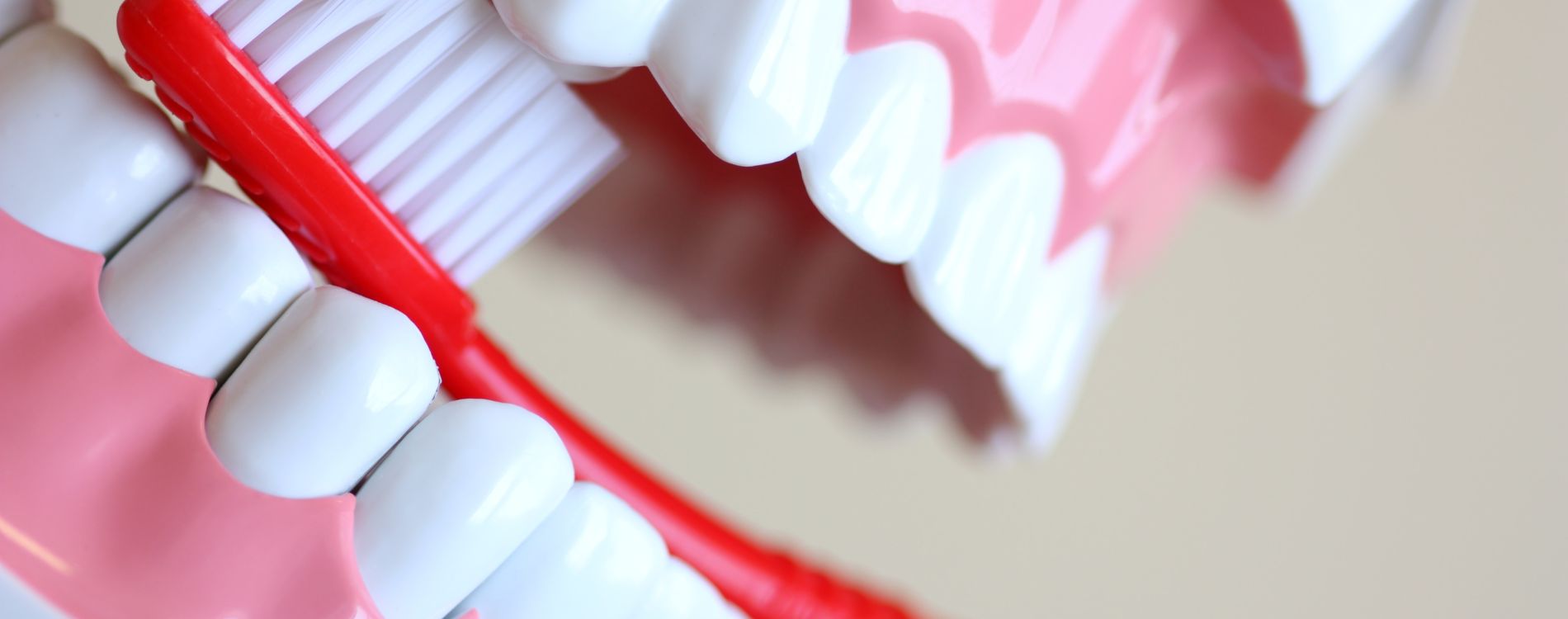 Sonrisa Gingival