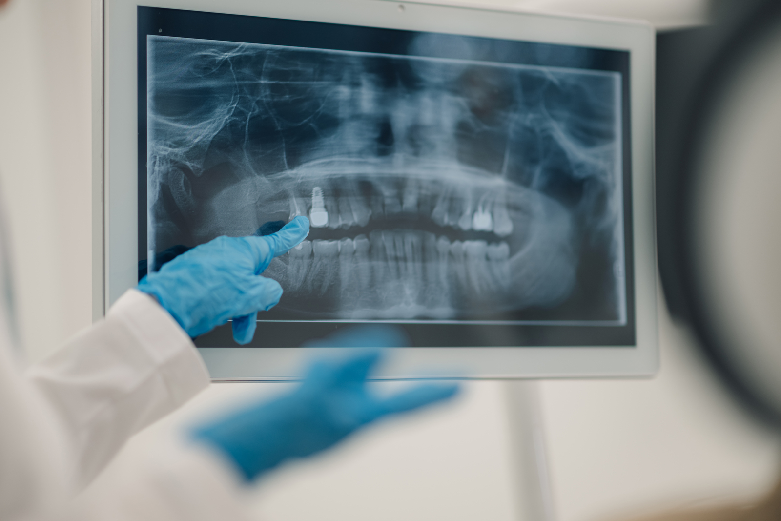 How to choose the ideal clinic for your digital dental X-ray