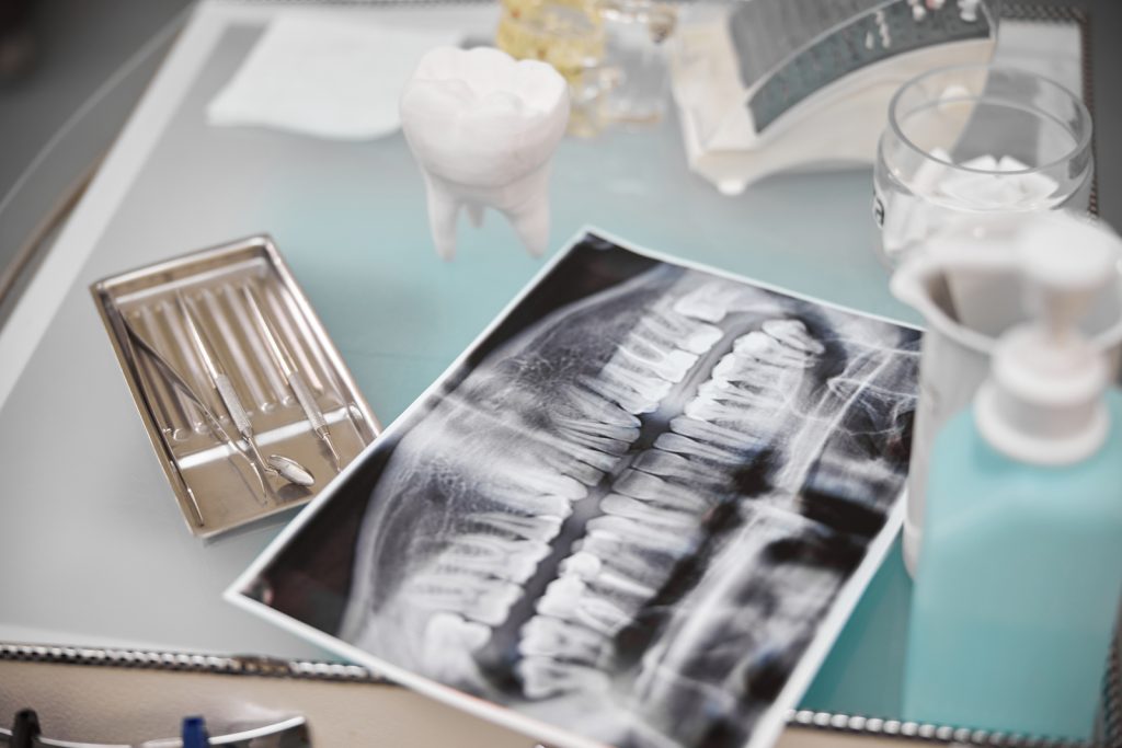 Traditional dental diagnoses limit your treatment