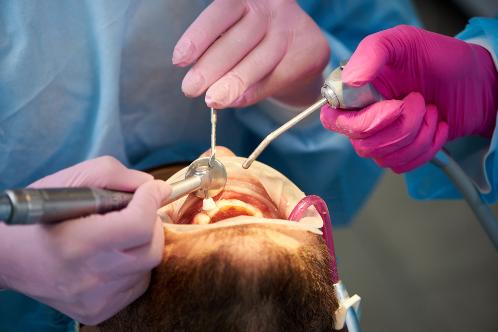 Problemas dentales que solucionamos con cirugía oral en Panamá