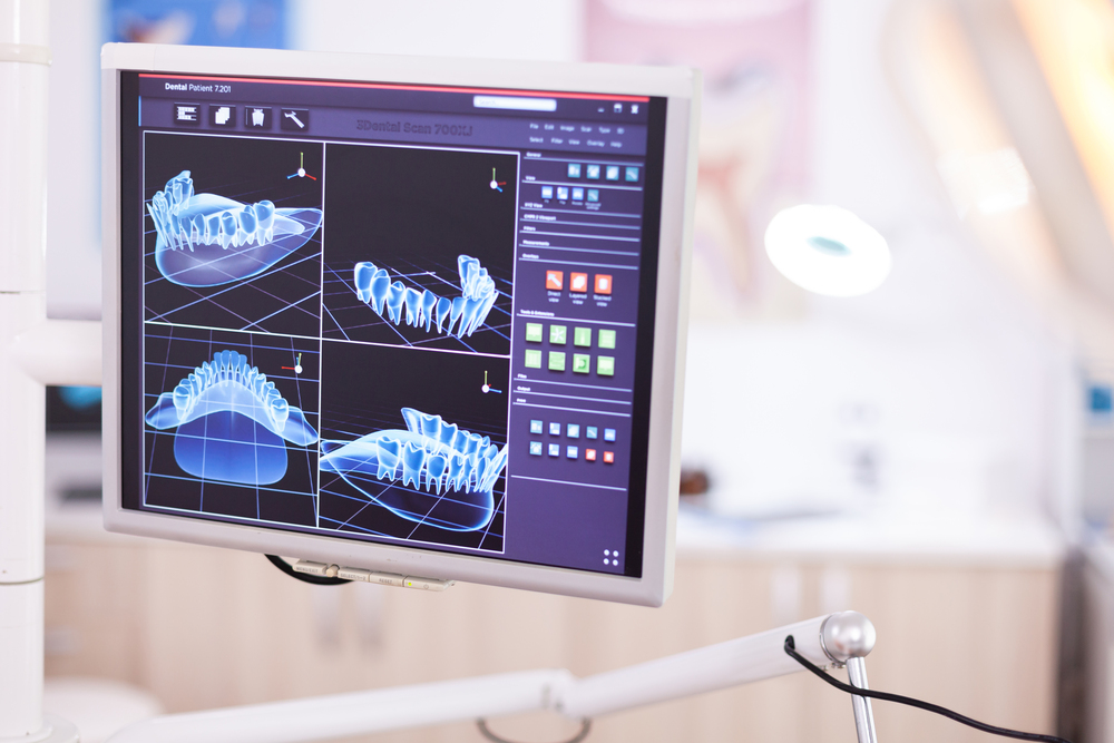 Frequently Asked Questions about Dental CT Scans in Panama