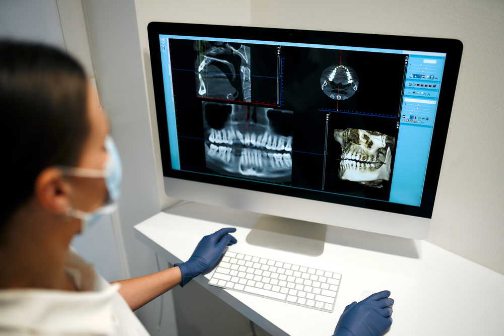 What a Dental CT Scan Entails
