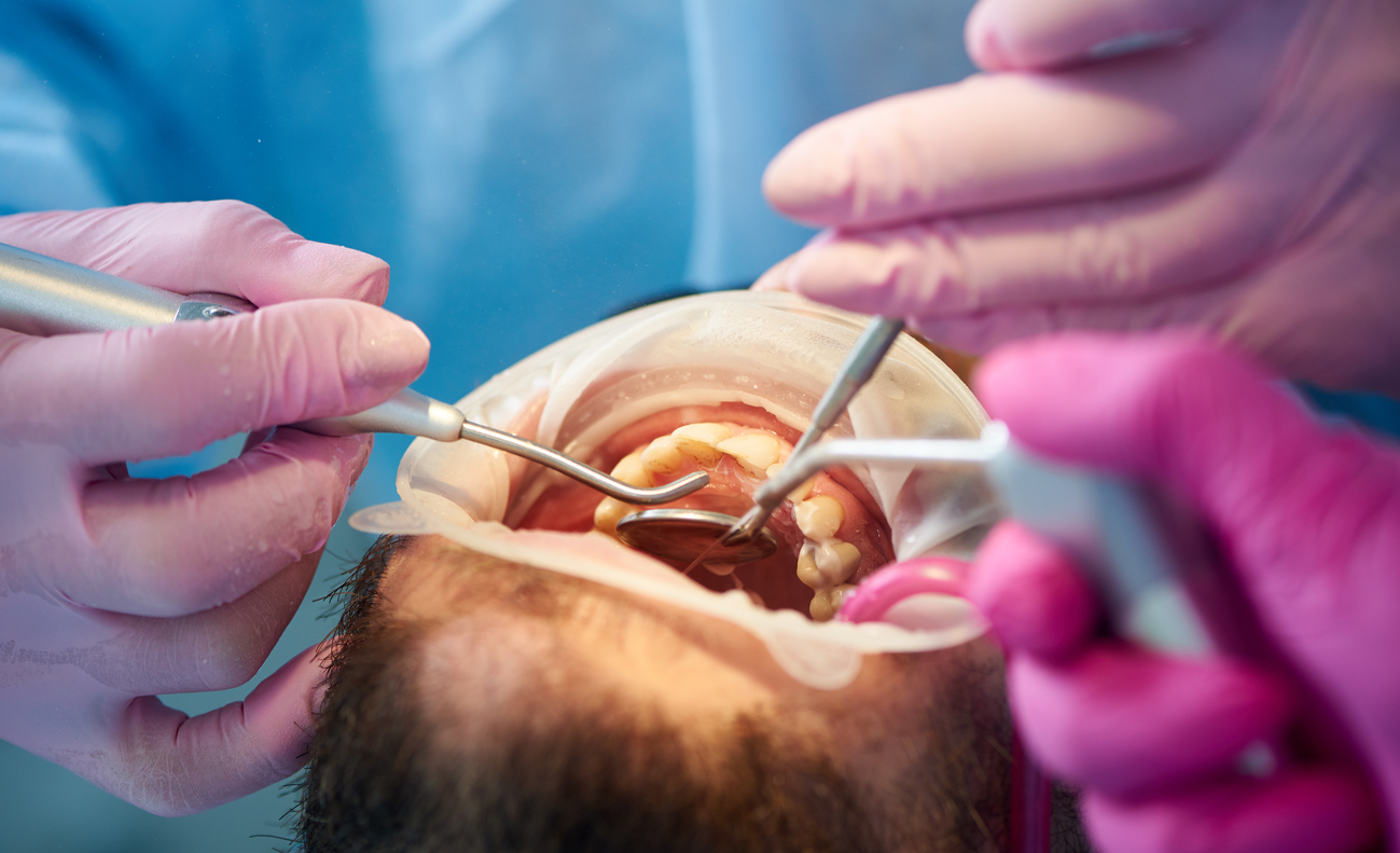 Qué pasa si la infección dental llega al hueso