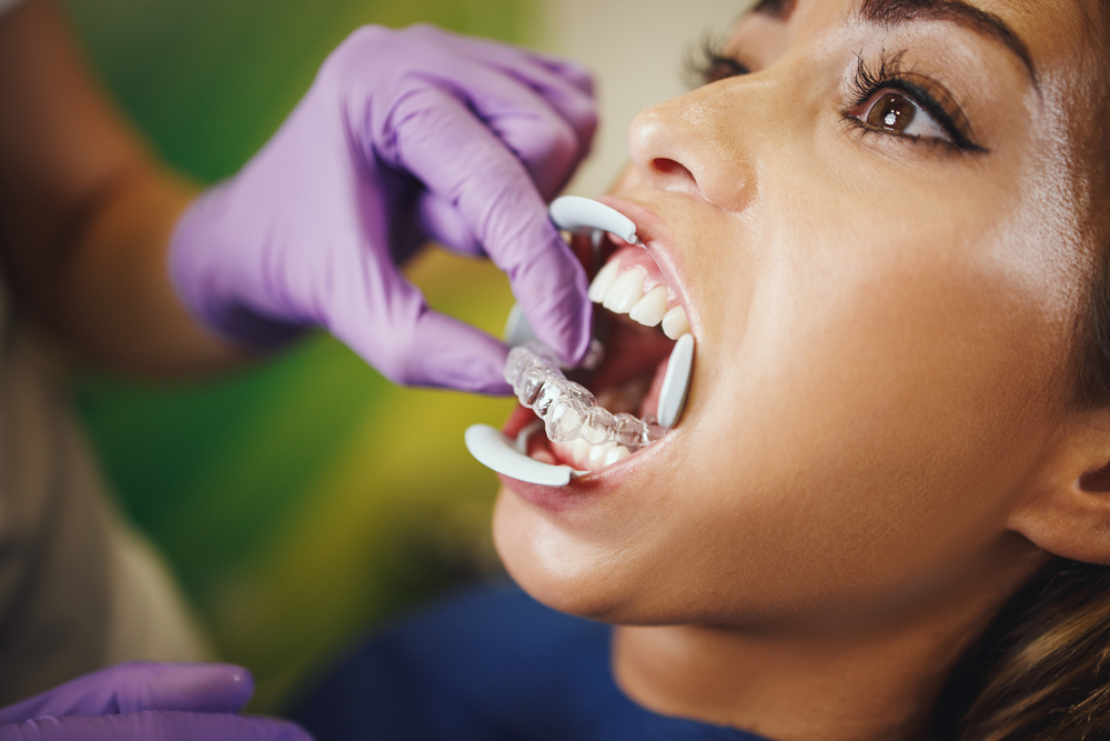 Tecnología Avanzada al Servicio de Tu Sonrisa en Clínica Dental Obarrio