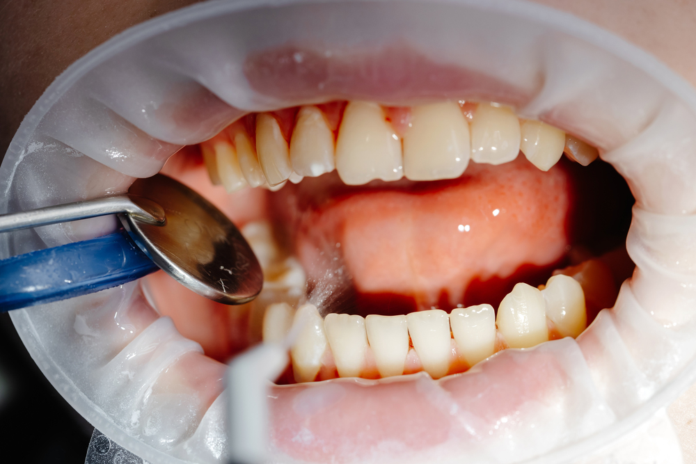 Un Enfoque Experto El Método de la Clínica Dental Obarrio