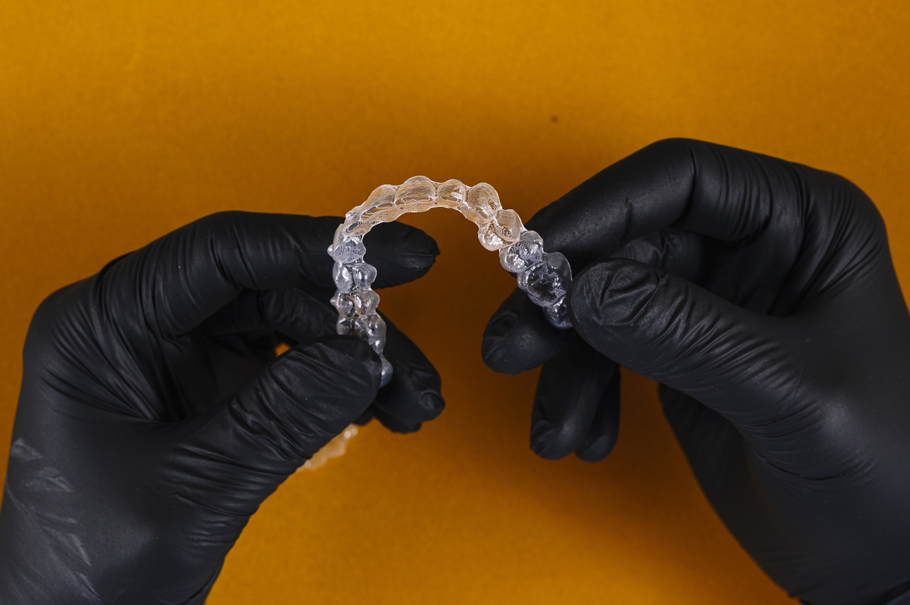 Cuándo Conviene Retirar Invisalign