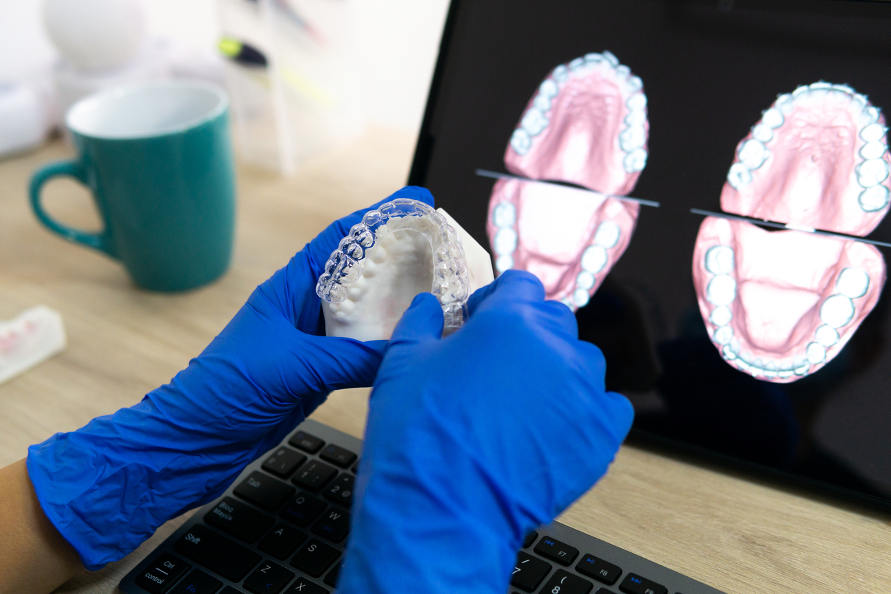 Invisalign vs Ortodoncia Autoligada Diferencias y Guía de Elección