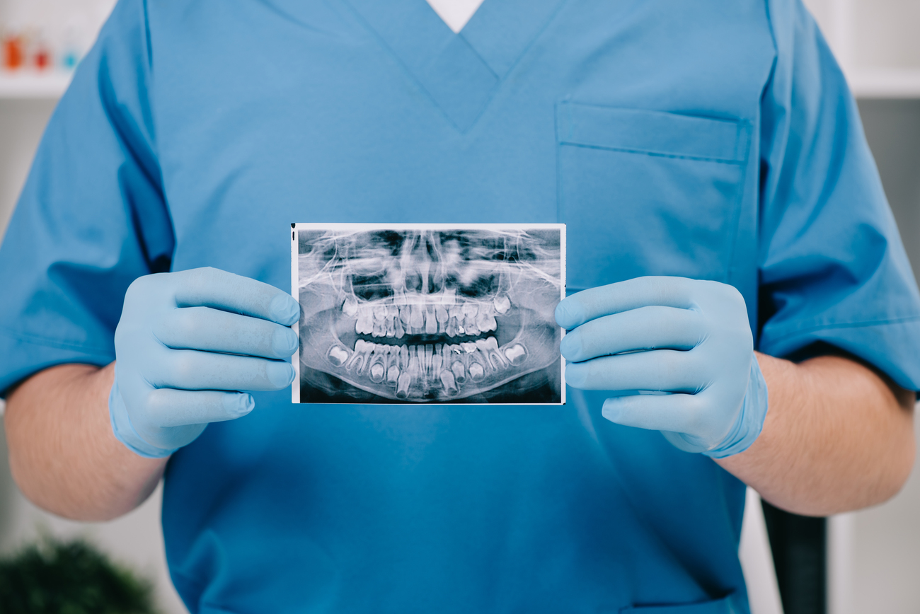 ¿Cuánto Tiempo Tarda una Endodoncia Duración por Tipo de Diente